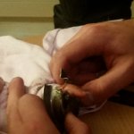 Uwięziony palec 1,5 rocznego dziecka